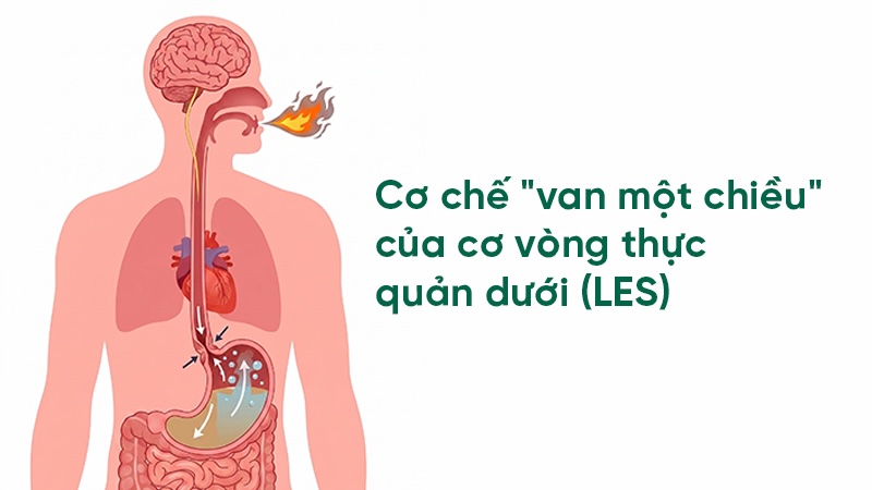 cơ chế van một chiệu