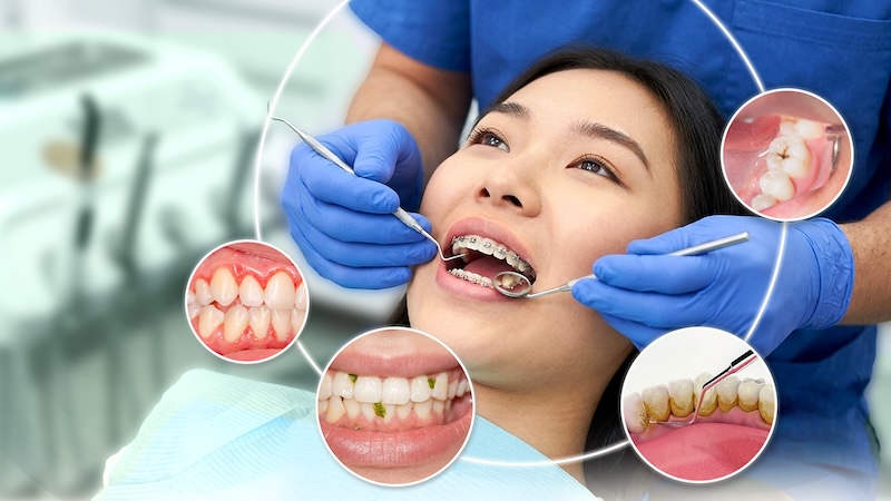 Vì sao bệnh nhân chỉnh nha dễ gặp các vấn đề về hơi thở