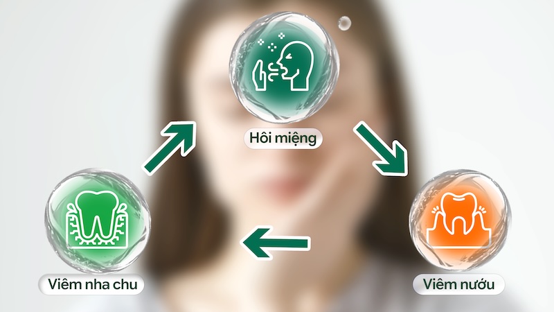 Chuỗi bệnh sinh - Từ rào cản cơ học đến vòng xoắn Viêm nha chu - Halitosis
