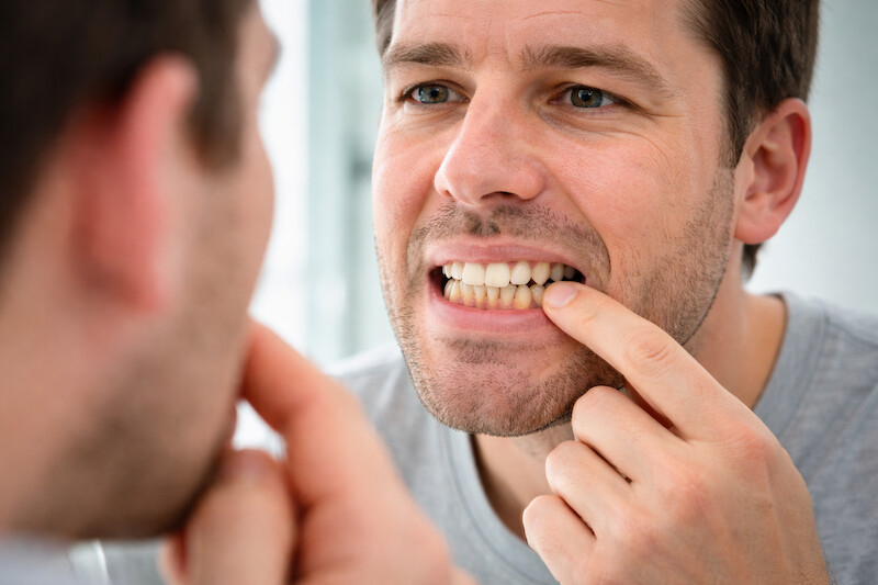 nước súc miệng mảng bám